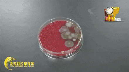 左肺大面积感染！男子连续3天高烧干咳！提醒：夏天首次开空调，千万不要先开制冷！
