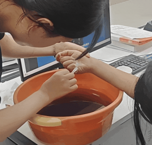 模型课上一个失误,女孩手指被强行“封住”!家长一定要提醒自家娃 模型课上一个失误,女孩手指被强行“封住”!家长一定要提醒自家娃