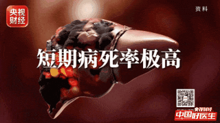 乙肝、脂肪肝、酒精肝…如何一步步拖成肝衰竭？