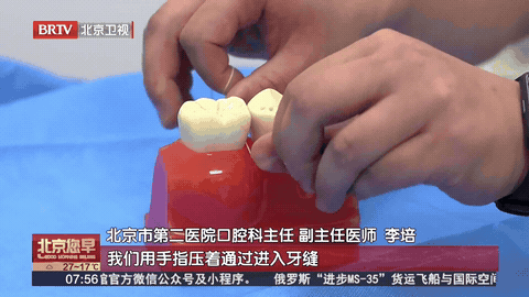 今天起,刷牙的方式调整一下!医生:别再“无效刷牙” 今天起,刷牙的方式调整一下!医生:别再“无效刷牙”