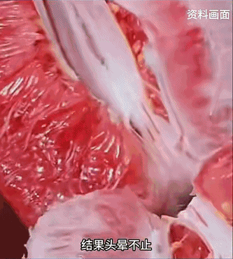 警惕!这种水果和85种药物“犯冲”,赶紧告诉家人! 警惕!这种水果和85种药物“犯冲”,赶紧告诉家人!