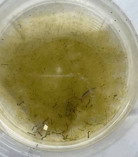 秋后蚊子来袭!预防“两热” 赶快消灭幼虫藏身地→ 秋后蚊子来袭!预防“两热” 赶快消灭幼虫藏身地→
