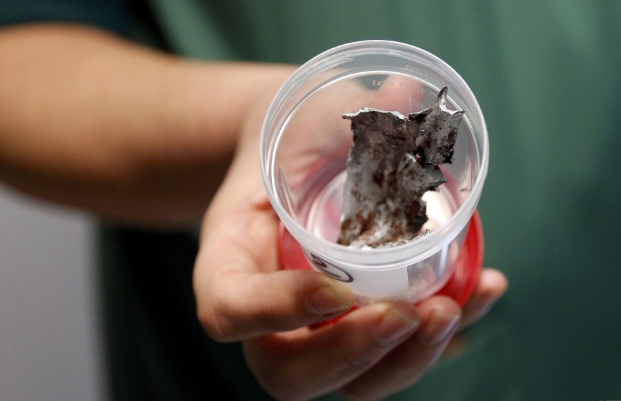 比利时医护人员展示恐袭伤者体内弹片