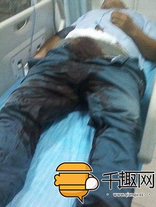 18岁的黑人,苦恼自己交不到女朋友,竟挥刀自宫!