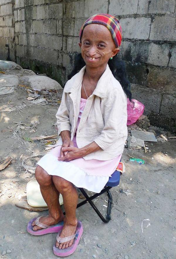 19岁少女拥有114岁的老太婆身体