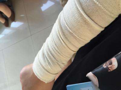 手术后刀口会很疼吗 f44d30758a661e3251b11e.jpg