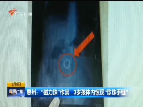 3岁男童体内惊现“珍珠手链” X光片结果让人大吃一惊