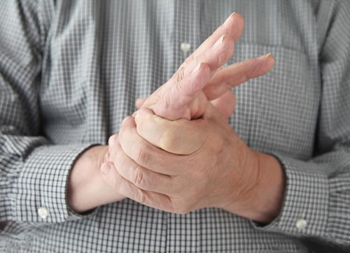 手指畸形一定是类风湿关节炎作怪吗？