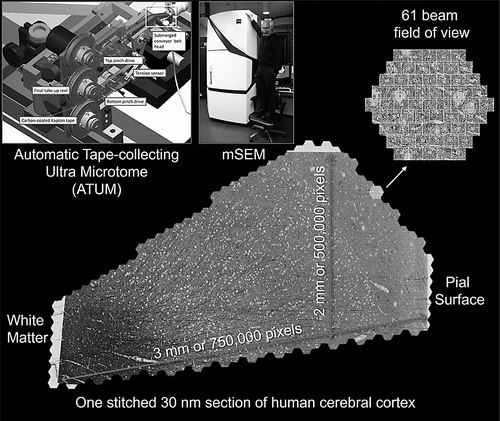 “大脑地图”的数字探秘