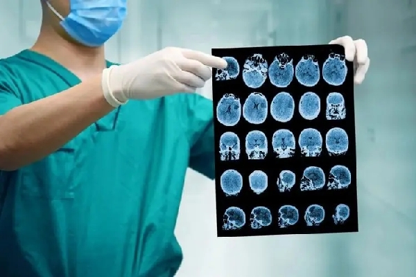 CT检查辐射量低、致癌风险可控