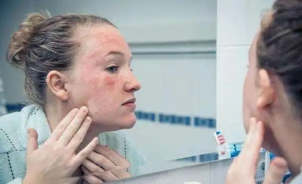 炎炎夏日 如何安全使用防晒“喷雾”