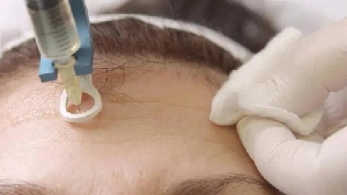 “鼠标手”纳入职业病目次是防治第一步