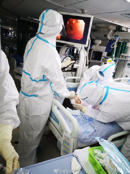 16月大患儿气管被堵 儿科专家支气管镜下紧急“拆弹”挽救生命
