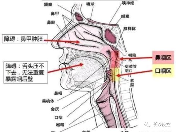 扁桃体周围血管解剖图图片