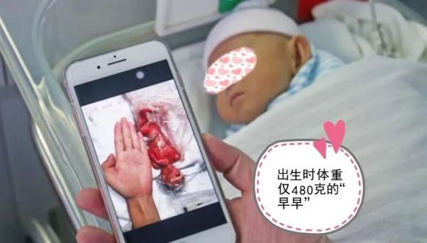 22周！不到1斤！深圳超早产宝宝“大力”出院！