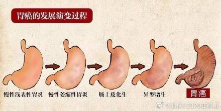 给我解释一下阿司匹林的功效_作用功效阿司匹林是什么药_阿司匹林的作用与功效与作用是什么