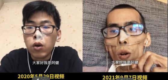 34岁抗癌博主示寂！一年时辰，癌症将帅小伙酿成这么……临了画面太酸心