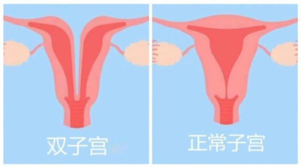 怀孕后宫颈口变化图图片