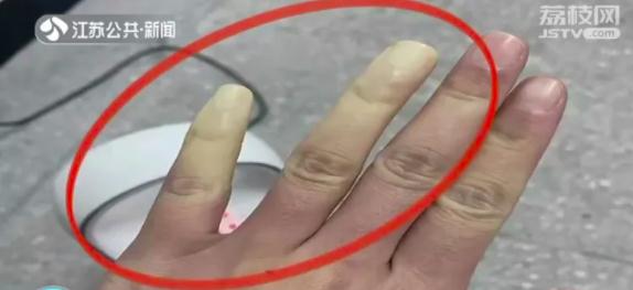 手指发白，伴有刺痛？小心得这个病！赶紧检查