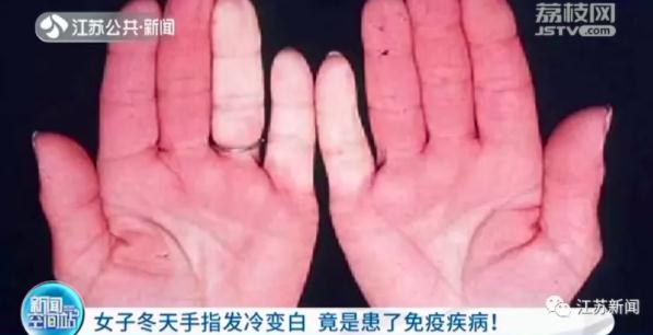 手指发白，伴有刺痛？小心得这个病！赶紧检查