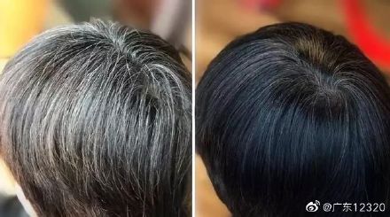 “一夜愁白头”是怎么回事？