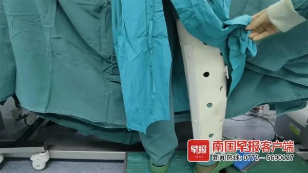 致敬！桂林一医生腿受伤后，戴着支具完成十几台手术