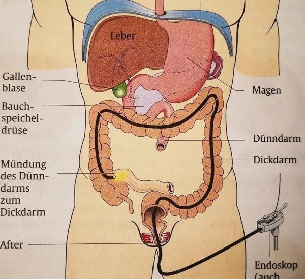 大便不成形是什么原因?需要做肠镜吗? 大便不成形是什么原因?需要做肠镜吗?