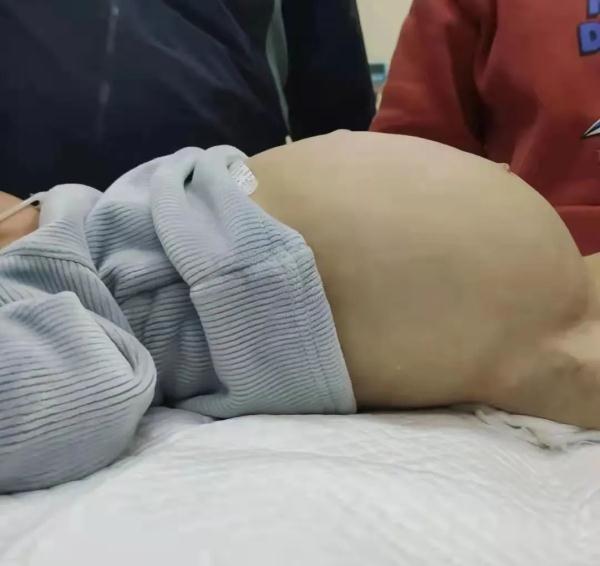 误吞这种玩具三个月，1岁男童腹胀如鼓