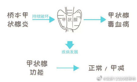 桥本氏甲状腺炎患者的饮食调理应注意