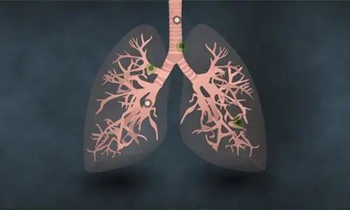 如果突然戒烟，到底“有益”还是“有害”呢？现在就告诉你答案