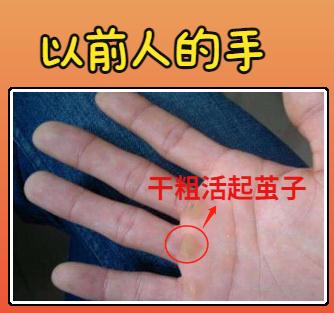 注意！手指出现这些症状，是心脏在向你发出求救……