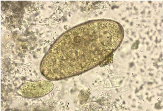 桂林女子肝脏被吃掉三分之一，“凶手”十分罕见，爱吃鱼腥草的人要注意