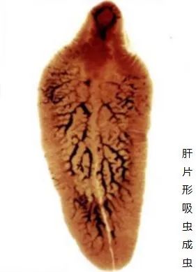 桂林女子肝脏被吃掉三分之一，“凶手”十分罕见，爱吃鱼腥草的人要注意