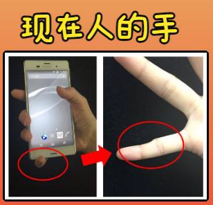 注意！手指出现这些症状，是心脏在向你发出求救……