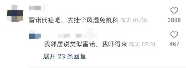 手指发白僵硬,冻伤了?其实是患上了这种极易被忽视的病!有人险些被截肢…… 手指发白僵硬,冻伤了?其实是患上了这种极易被忽视的病!有人险些被截肢……