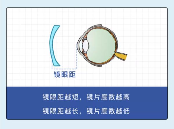 眼镜老是“一高一低”？别忽视！近视度数可能会蹭蹭上涨！