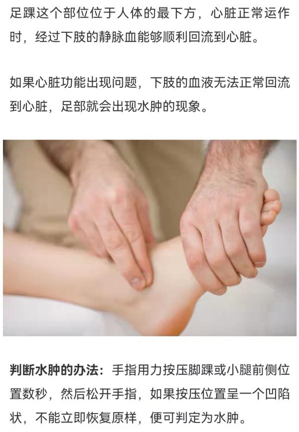 耳垂出现这条折痕，也许是大病预警！不花钱的“养心法”，早知道早受益