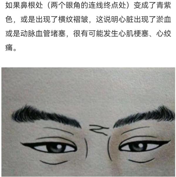 耳垂出现这条折痕，也许是大病预警！不花钱的“养心法”，早知道早受益