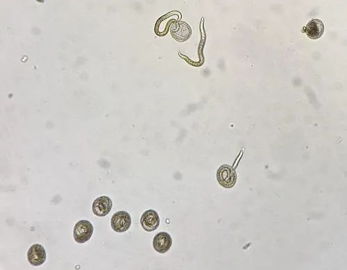 8岁男童眼球发白、视网膜脱落,或与这件事有关!很多家庭都有 8岁男童眼球发白、视网膜脱落,或与这件事有关!很多家庭都有