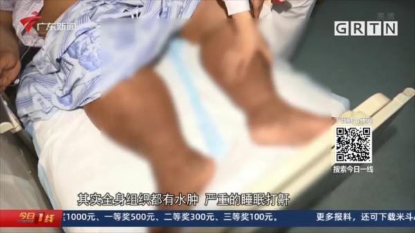 500斤小伙胖到半年无法下床，自述：喝水都胖！医生这么说……