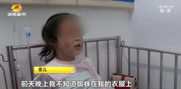 千万小心!持续升温,它们开始活跃!湖南女孩因此全身红疹肿胀…… 千万小心!持续升温,它们开始活跃!湖南女孩因此全身红疹肿胀……