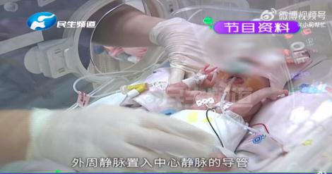 报喜！出生时790g的拇指姑娘，现在“变身”了...