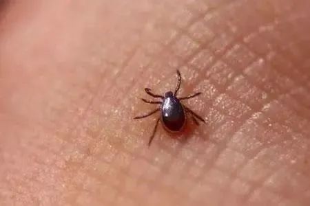 小心!一升温就活跃,有女孩因此全身红疹肿胀… 小心!一升温就活跃,有女孩因此全身红疹肿胀…