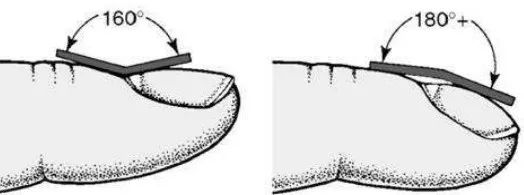 手上这部位鼓起！表明你的心脏：正在向你发出求救！