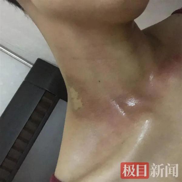 患癌、失业、分手......多次化疗的95后女孩,考研成绩405分! 患癌、失业、分手......多次化疗的95后女孩,考研成绩405分!