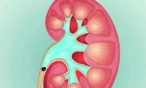 喝水少容易得肾结石，喝水多要小心肾积水，是真是假？