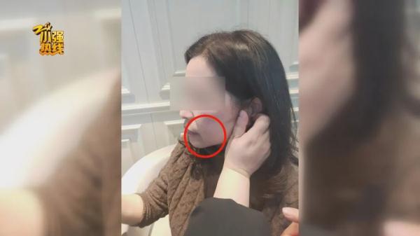 花了五万元做整形，术后左右脸不对称要维权，医院：手术不是我们做的