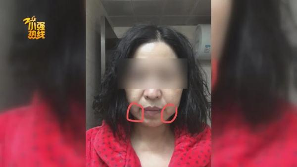 花了五万元做整形，术后左右脸不对称要维权，医院：手术不是我们做的
