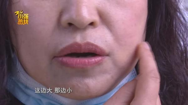 花了五万元做整形，术后左右脸不对称要维权，医院：手术不是我们做的