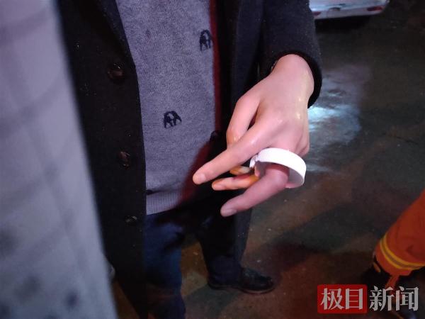 男子中指卡进桶盖无法拔出，“蓝朋友”上门解救